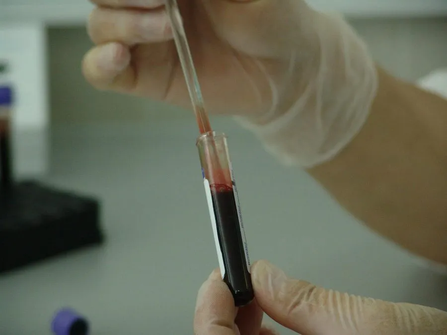 Testy dna badania genetyczne - kiedy warto wykonywać?